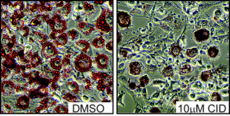 Fettzellen, die während ihrer Differenzierung mit einem PKD-Hemmstoff behandelt wurden (Abbildung rechts), speichern sehr viel weniger Fetttröpfchen (rot) als unbehandelte Zellen (Abbildung links).