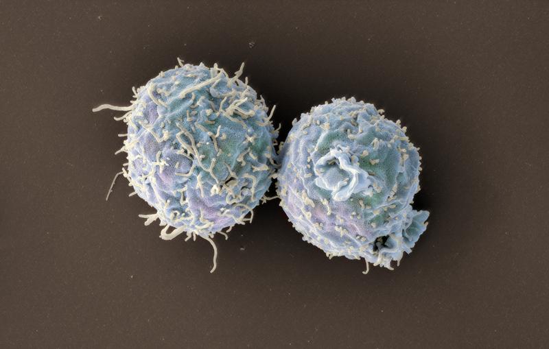 Scanning electron microscopy image of engineered T cells lacking coronin 1. 