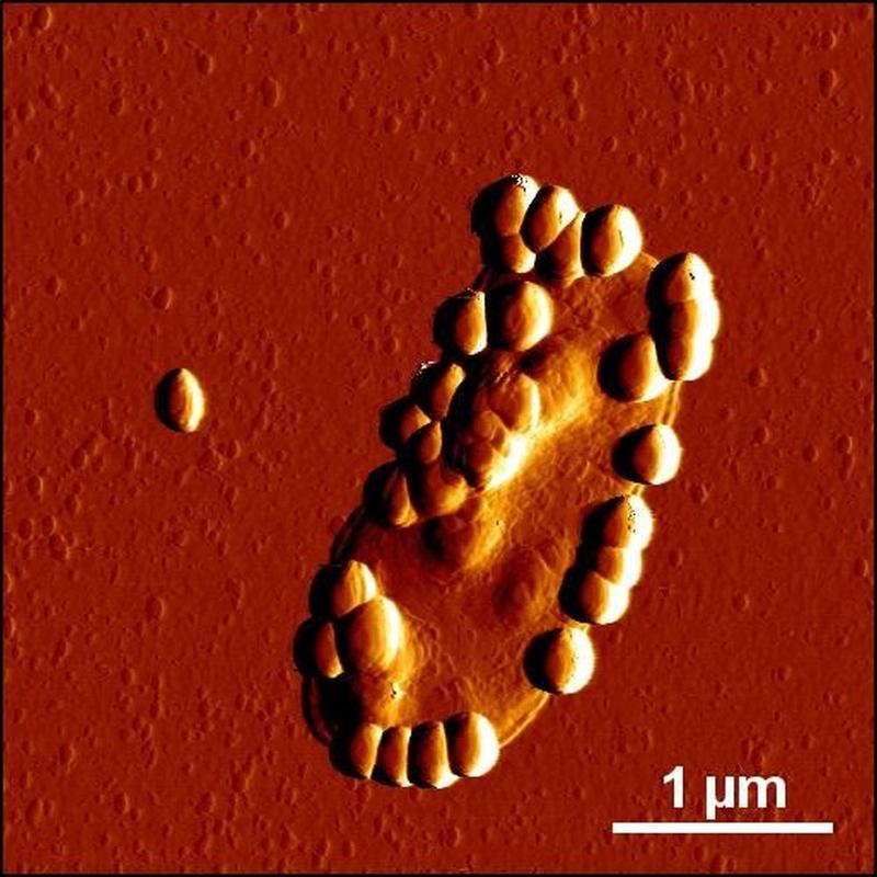 Atomkraftmikroskopische Aufnahme eines Darmbakteriums mit angelagerten Silika-Nanopartikeln. 