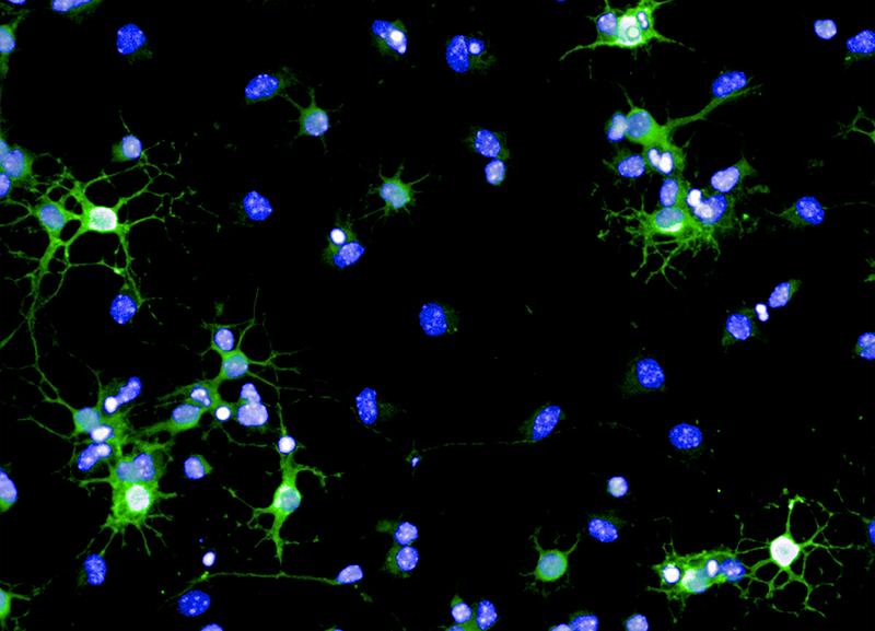 Myelin-Reparaturzellen (Oligodendrozyten) einer Maus in der Kulturschale. Sie stellen Myelin her (grün), das sie für die Reparatur der Nervenzell-Ummantelung verwenden. Zellkerne sind blau angefärbt.