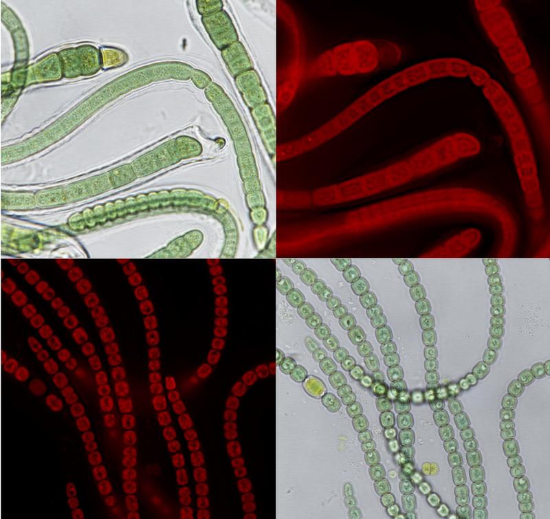 Lichtmikroskopische Aufnahmen der Cyanobakterien Calothrix desertica DSM 106972 (oben) und Anabaena variabilis DSM 107003 (unten)