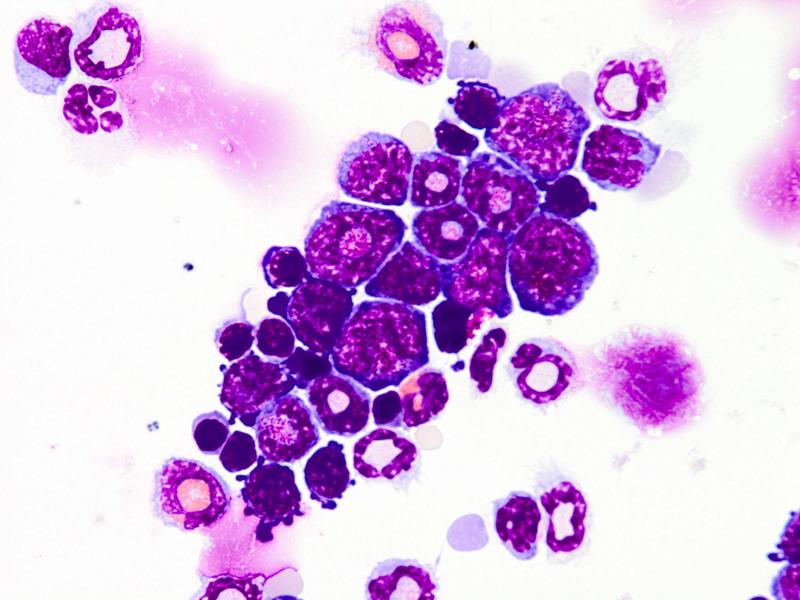 Knochenmarkzellen der Maus (Zytospin, May-Grünwald / Giemsa Färbung)
