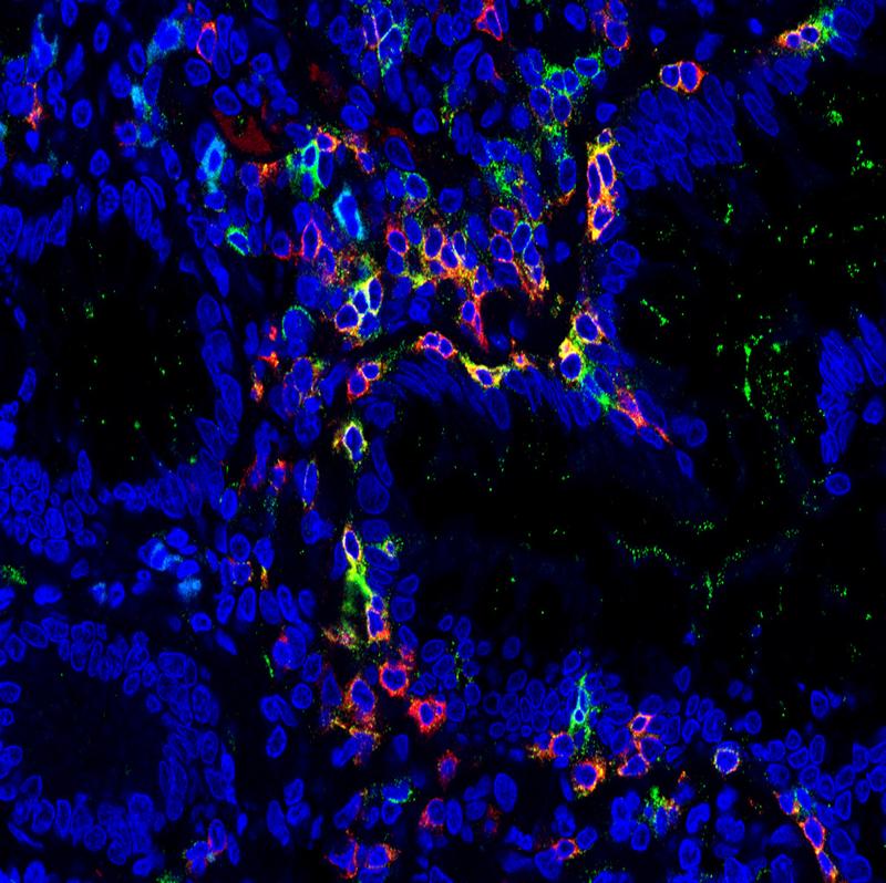 TRM-Zellen (in der Aufnahme gelb) lösen vermutlich Entzündungsschübe bei chronisch-entzündlichen Erkrankungen wie Morbus Crohn oder Colitis ulcerosa aus. Das haben jetzt FAU-Forscher herausgefunden.