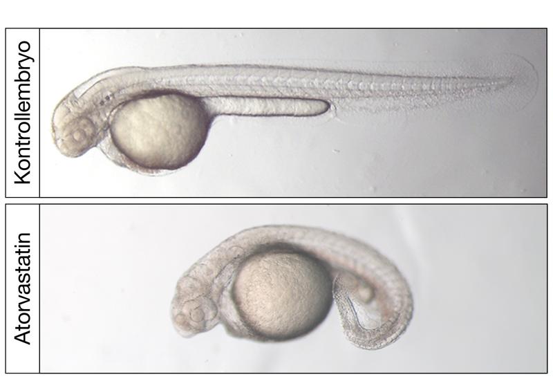 Lichtmikroskopische Aufnahme von zwei Tage alten Zebrafischembryonen. Behandlung mit dem Cholesterinsenker Atorvastatin führt zu stark deformierten Zebrafischembryonen