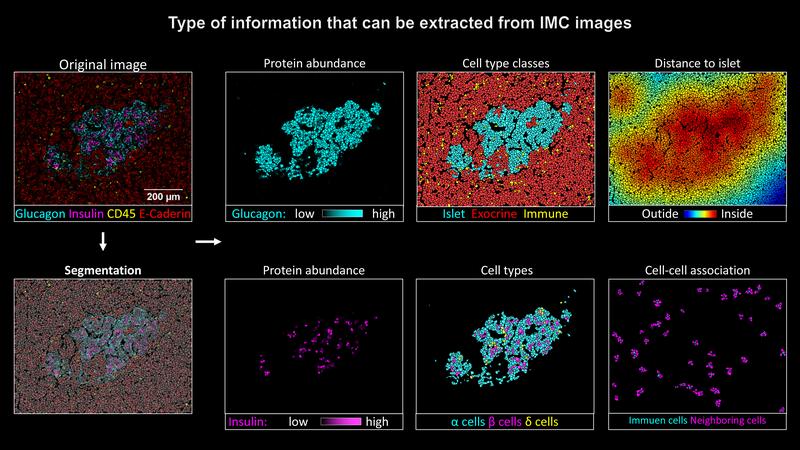 Imaging mass cytometry can make a valuable contribution to a better understanding of how type 1 diabetes progresses