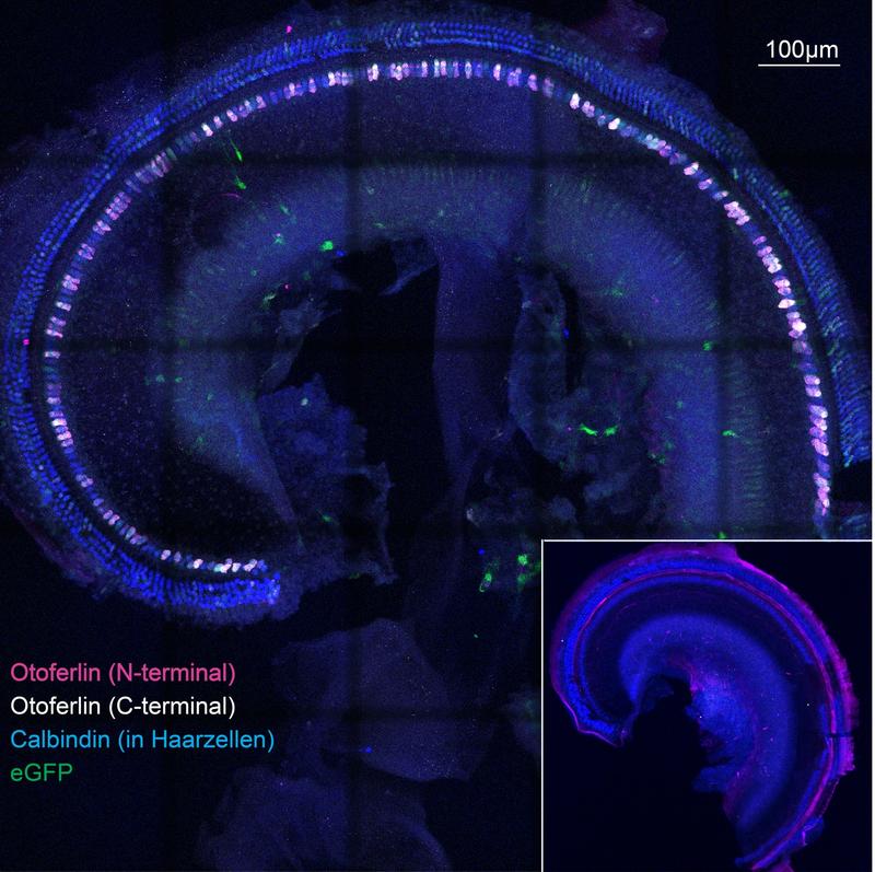Apikale Windung eines Innenohrs einer Dual-AAV behandelten Otoferlin-knock-out Maus ....