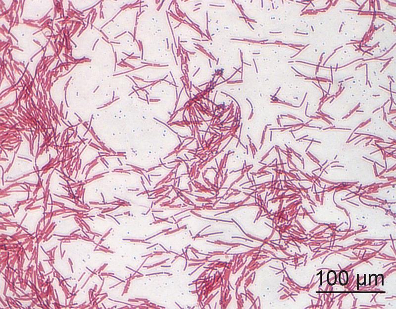 Lichtmikroskopische Aufnahme von Clostridium ramosum nach Gram-Färbung. 
