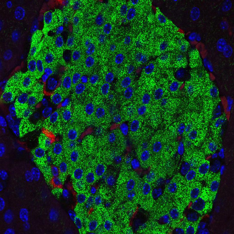 Fluoreszenzmikroskopie einer Langerhans-Insel