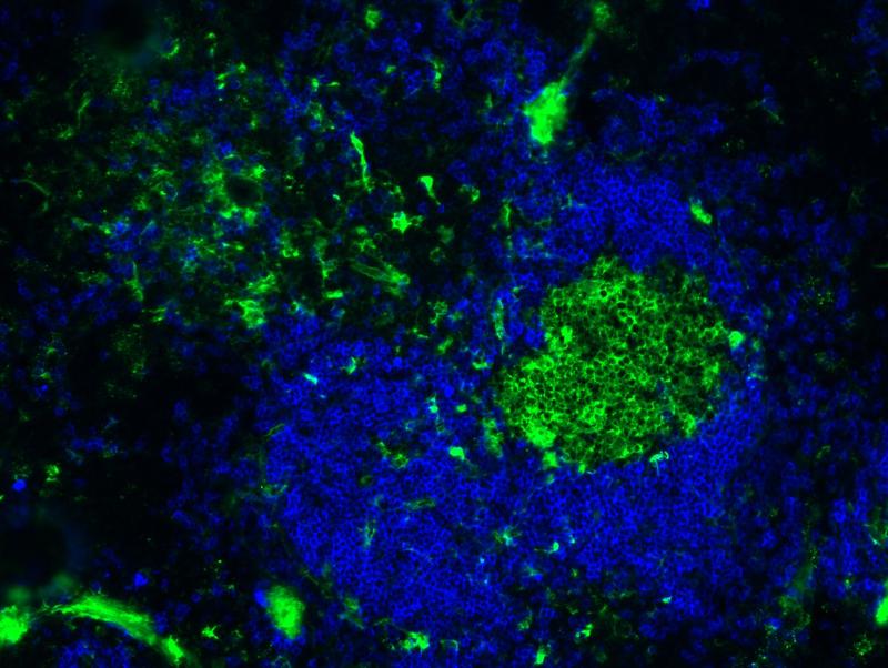 B2-Zellen in der Milz: Die Milz ist eines der immunologischen Organe, in den follikuläre B-Zellen (blau) und B-Zellen der Keimzentren (grün) hochaffine Antikörper-Antworten entwickeln