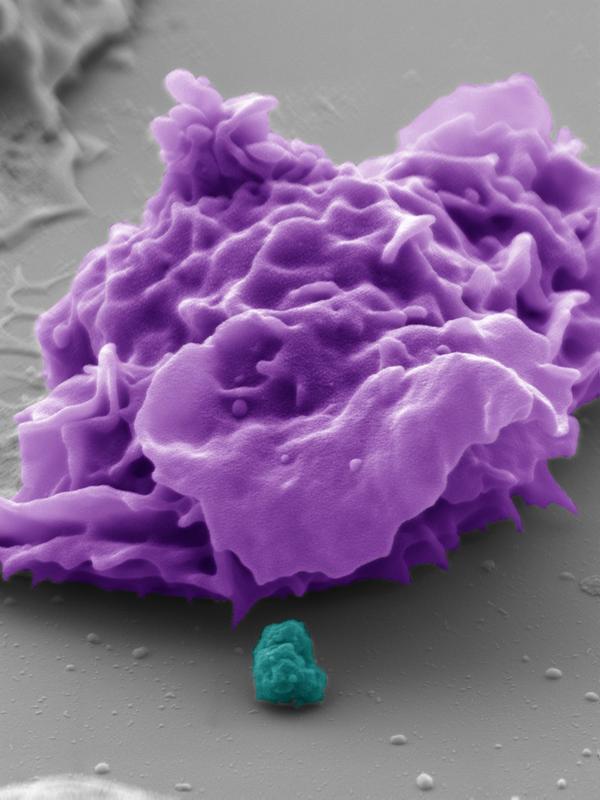 Die pseudokolorierte elektronenmikroskopische Aufnahme zeigt eine menschliche Fresszelle (lila) und ein Bakterium (türkis).