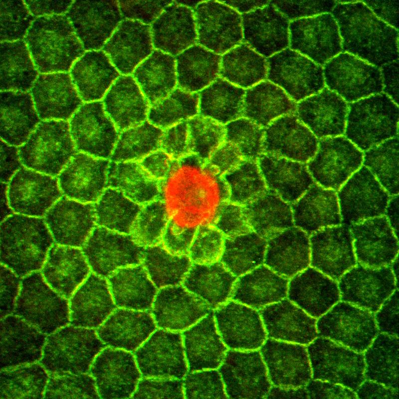 MPC (rot), umgeben von den konkurrierenden Granulosazellen (grün)