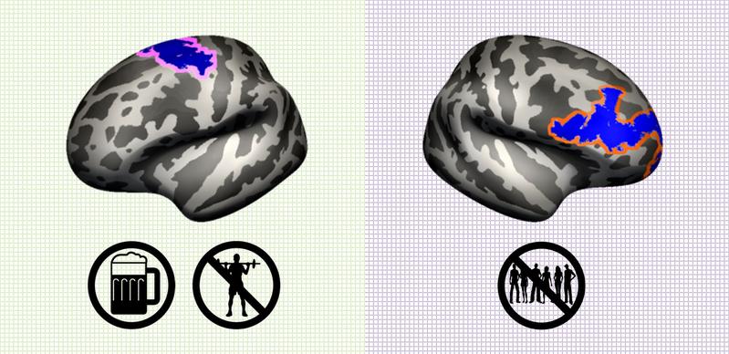 Wirken sich negativ auf die Gehirnstruktur aus: Alkohol und mangelnde sportliche Aktivität (links) und fehlende soziale Interaktionen (rechts)