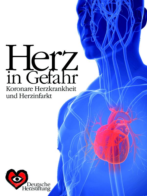 Der Herzstiftungs-Ratgeber "Herz in Gefahr" informiert über Symptome, Diagnostik und Therapie von KHK und Herzinfarkt.