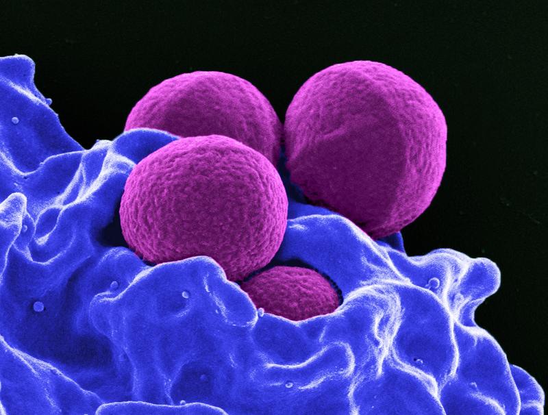 Staphylococcus aureus gehört zu den gefürchteten Krankenhauskeimen