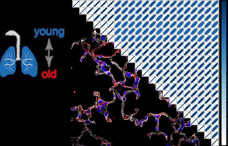 Multi-omics analysis of lung aging 