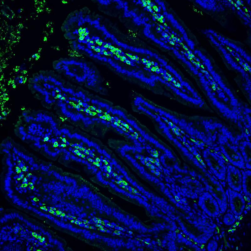 Dünndarmschleimhaut von keimfreien Mäusen mit IgA-produzierenden Plasmazellen (grün). 