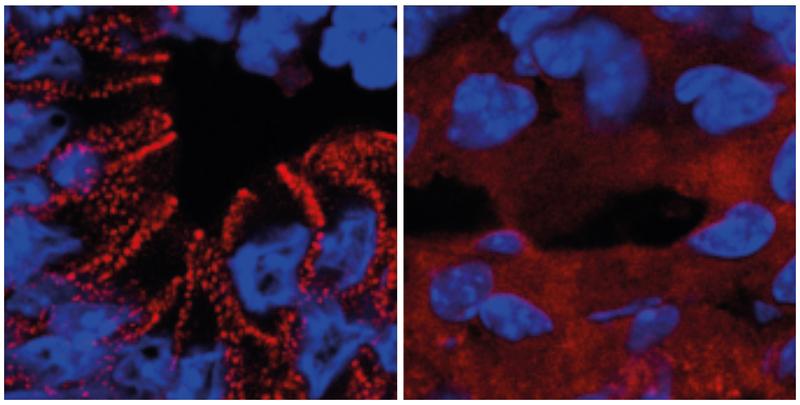 In gesunden Mäusen wird das rot markierte Protein (Desmoplakin) von den Darmzellen in Desmosomen eingebaut (links). Ein fehlerhafter Insulinsignalweg führt zum Verbleib des Proteins im Zellplasma (