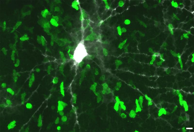 T cells targeting beta-synuclein invade the grey matter. Shown here is a rat’s brain cortex, one frame of a microscopic recording.