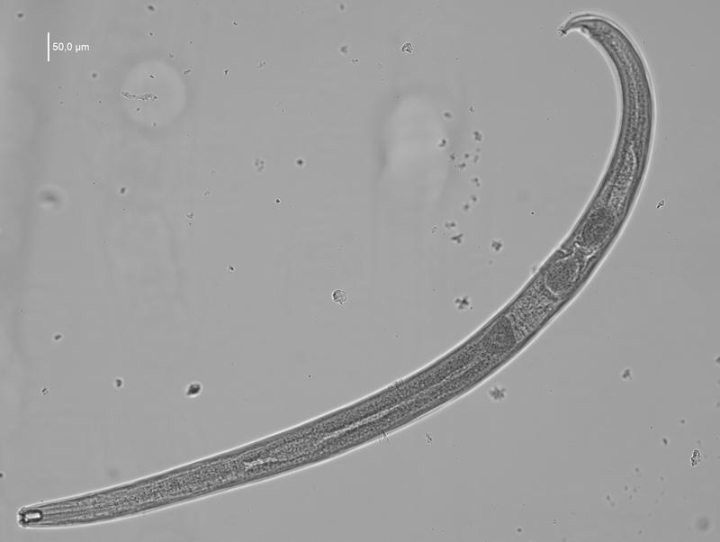 Prionchulus sturhani unter dem Mikroskop.