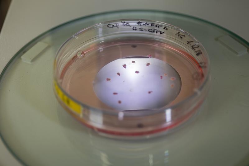 Wie kleine Stecknadelköpfe sehen die gehirnähnlichen Zellkulturen in der Petrischale aus