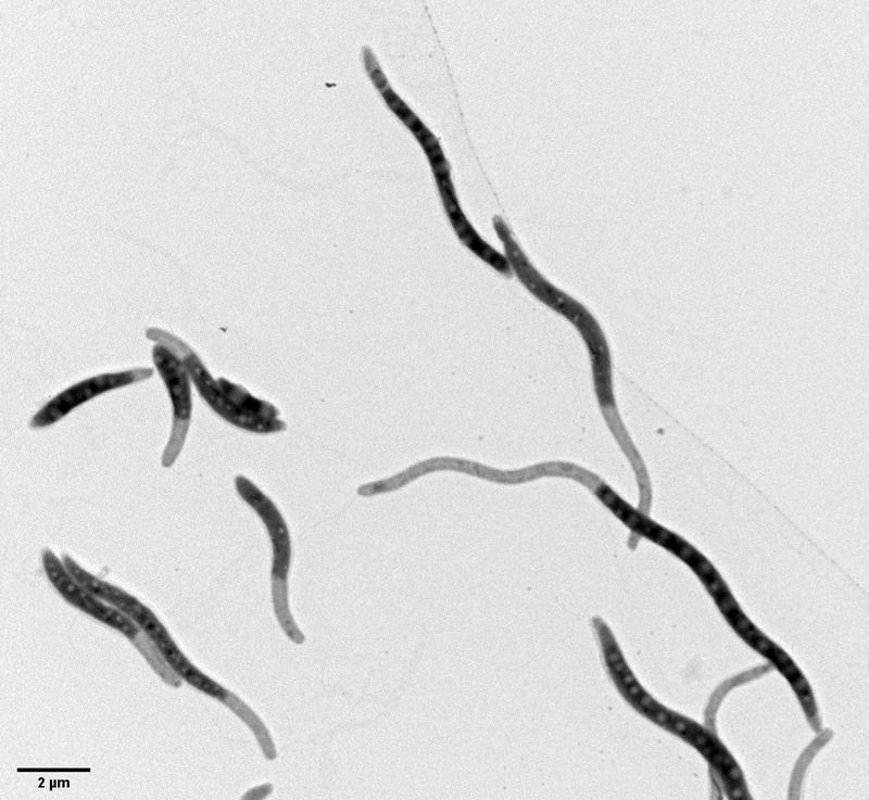 Wenn es in der Bakterienzelle zu einer Überproduktion des Proteins PopZ kommt, bilden sich lange dünne Fortsätze, die in der elektronenmikrosopischen Aufnahme auffällig hell erscheinen.