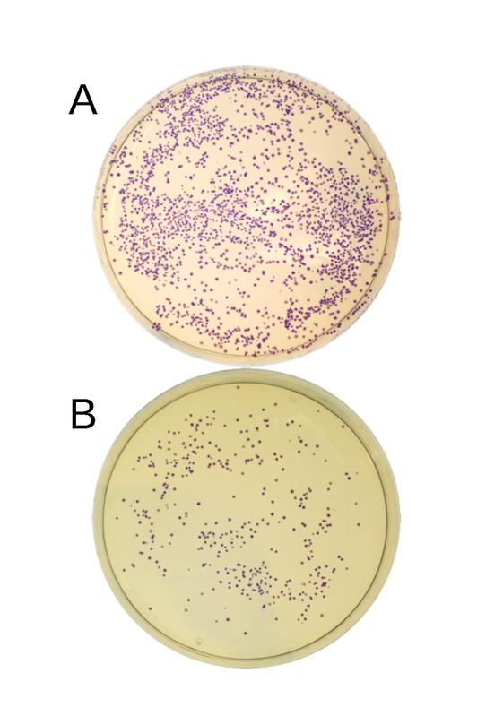 E. Coli-Bakterien, die blaues Protein produzieren. Die Produktion wird durch zwei (A) bzw. drei (B) DNA-Fragmente gesteuert. Die Zahl der Kolonien lässt auf die Effizienz der Klonierung schließen.