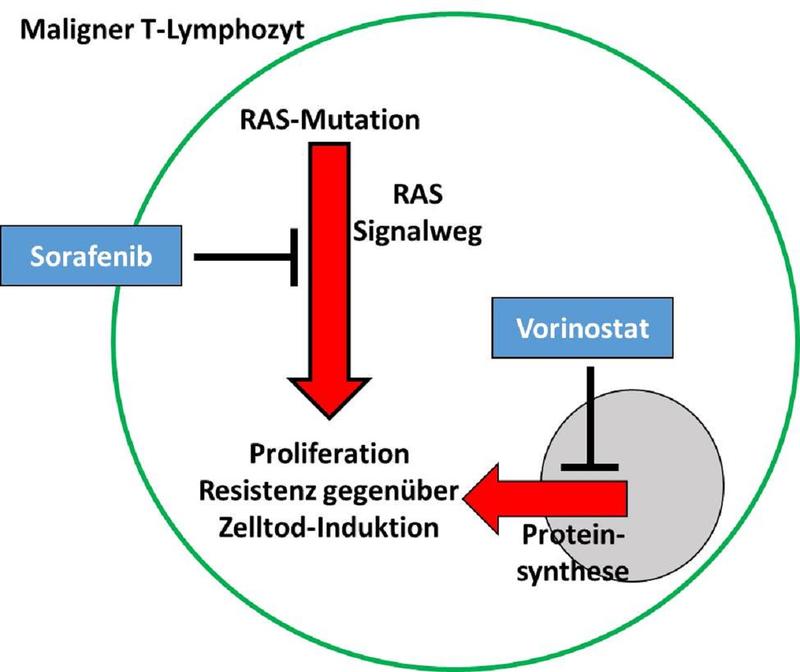 Schematische Darstellung eines malignen T-Lymphozyten des Sézary-Syndroms: Unter der Kombinationstherapie mit Sorafenib und Vorinostat ist ein massives Absterben der Tumorzellen zu beobachten.