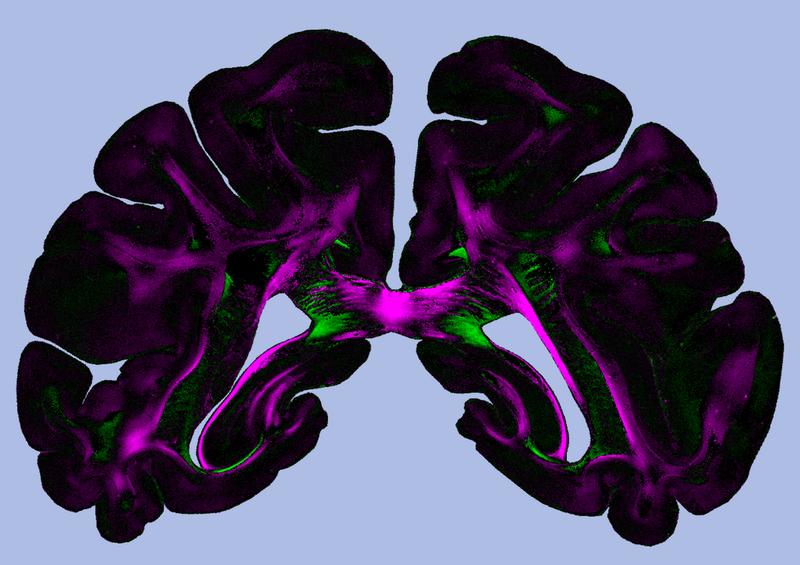 „Diattenuation Imaging“ (DI) liefert Strukturinformationen, die bisher nur schwer zugänglich waren.