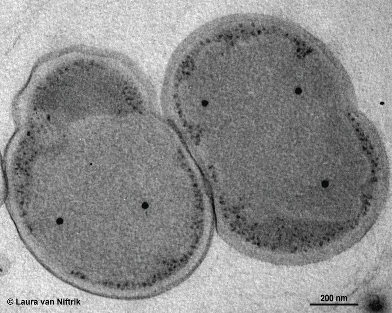 K. stuttgartiensis unter dem Transmissionselektronenmikroskop. Es wächst in Form einzelner Zellen. Die Art kommt in Süßwasser, auch in Kläranlagen, vor. 