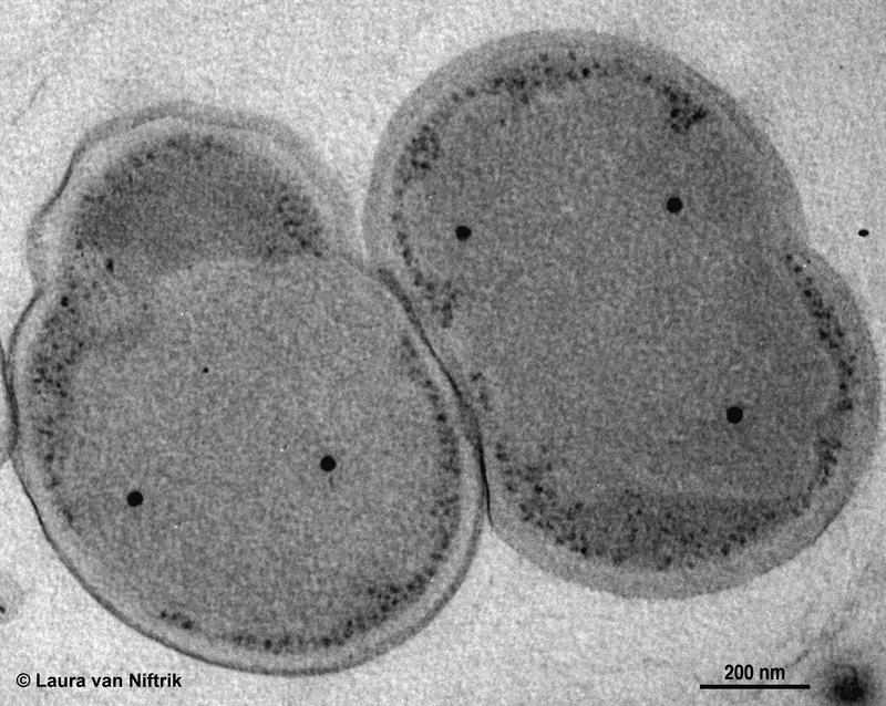 Kuenenia stuttgartiensis, here seen under a transmission electron microscope, is a model anammox microorganism, which grows as single cells.