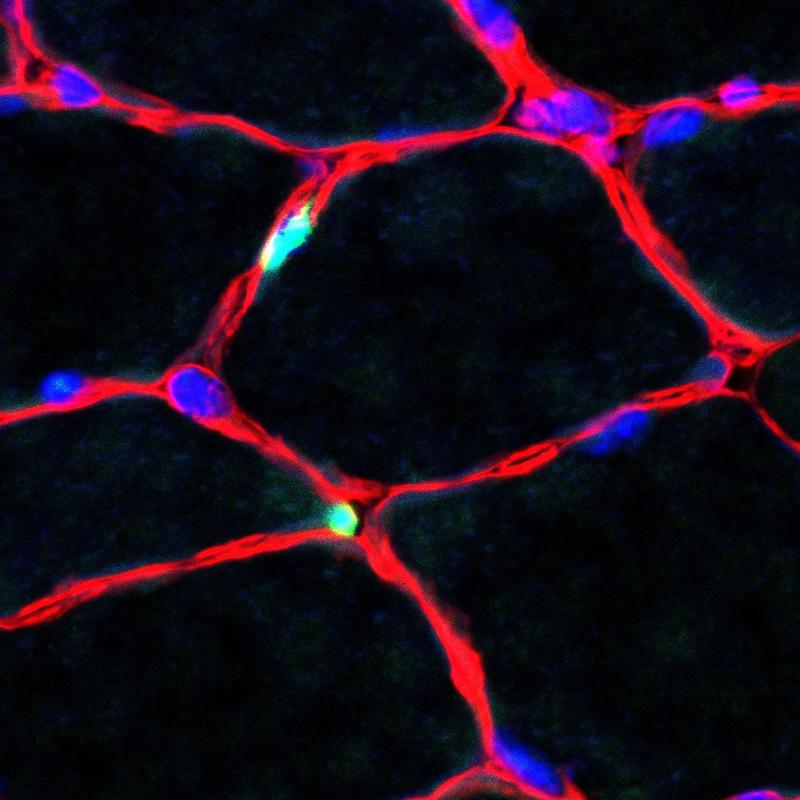 Skelettmuskulatur: Die Kerne der Muskelstammzellen sind in grün zu sehen. Die Zellkerne der Muskelfasern sind in blau, die Umgrenzung um die Muskelfasern (Basallamina) ist rot. Maßstab: 20µm.