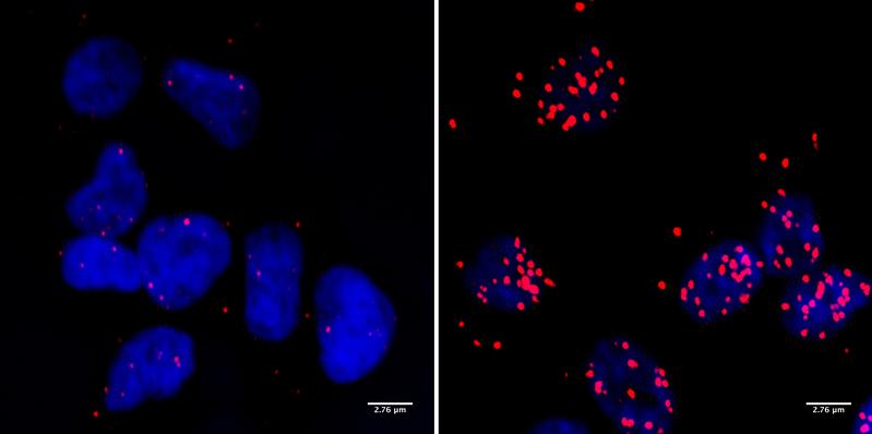 Neuroblastom-Zellen: Die roten Punkte markieren Stellen, an denen BRCA1 in engem Kontakt mit der RNA-Polymerase II vorkommt. Das ist nur dann der Fall, wenn auch das Protein MYCN vorliegt (r.). 