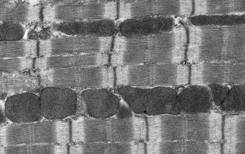Transmission electron micrograph of heart muscle. The repeating striped elements represent sarcomeres, and the dark structures represent mitochondria.