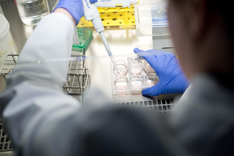 In den Forschungslabors des Uniklinikums Würzburg wird unter anderem daran gearbeitet, das Anwendungsspektrum von CAR-T-Zellen zukünftig auf möglichst jede Krebsart auszuweiten.