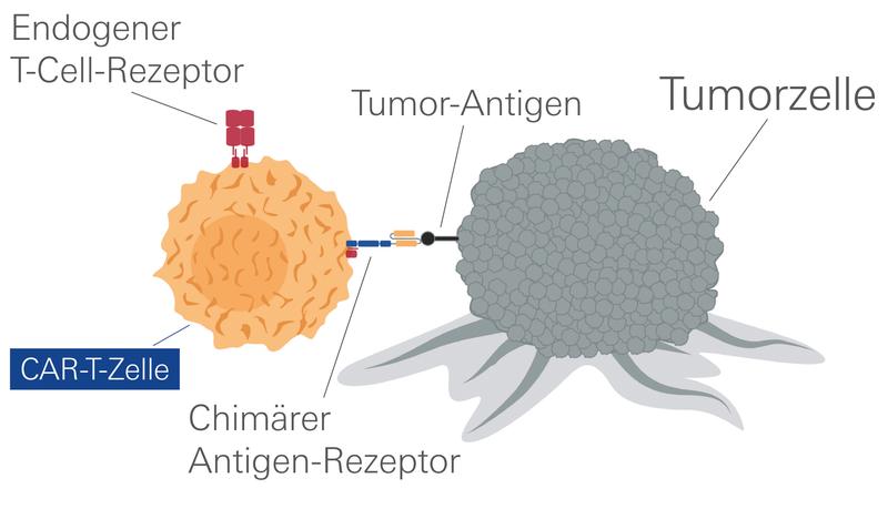 Durch einen Chimären Antigen-Rezeptor können T-Zellen Tumorzellen erkennen und zerstören.