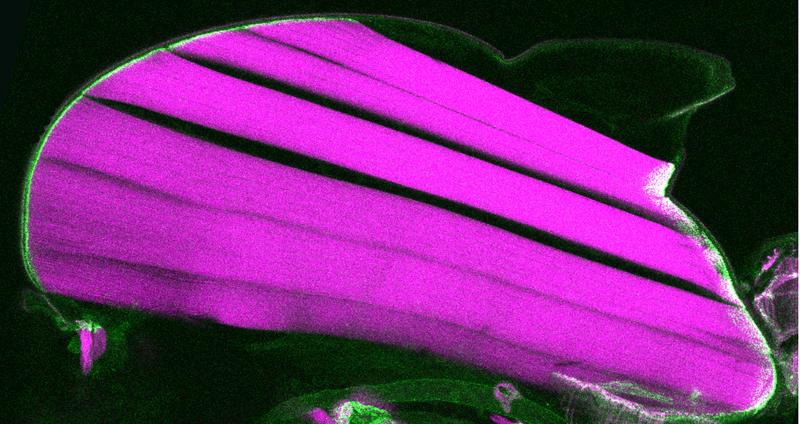 Lengthwise cut through the thorax of a fruit fly having an inserted force sensor in the talin protein. The force sensor on the muscle-tendon connections is green and the flight muscles magenta. 