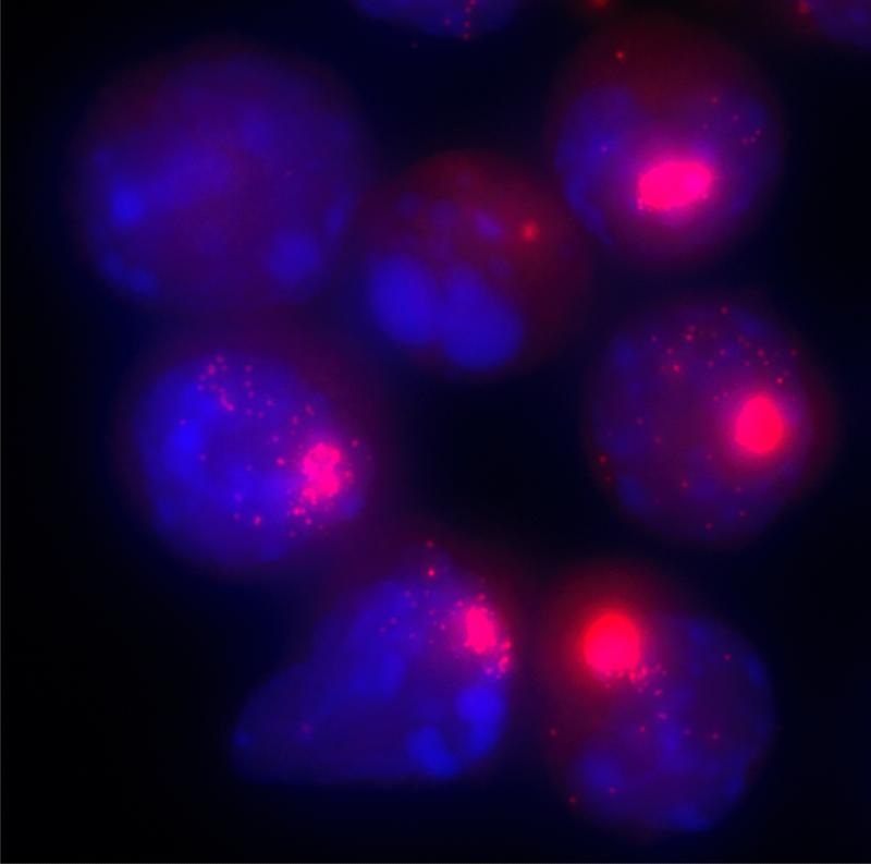 Zellkerne von weiblichen Zellen. Die Xist-Moleküle, die für die Inaktivierung des zweiten X-Chromosoms verantwortlich sind, sind mit einem roten Farbstoff markiert.