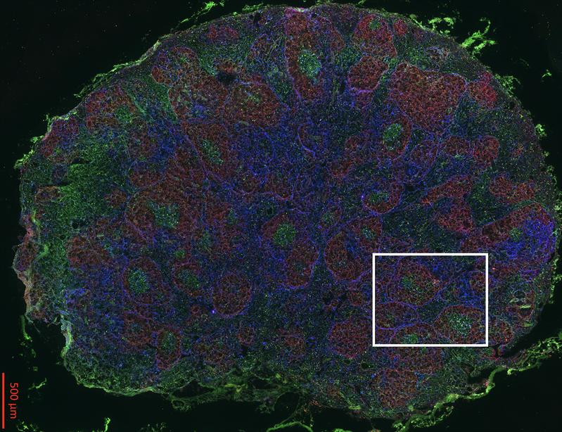 Reaktiver Lymphknoten. Ein Lymphknoten wurde gefriergetrocknet und in mehreren Schritten mit fluoreszierenden Antikörpern gefärbt: CD4 in blau, IgD in rot, GL7 in grün. 