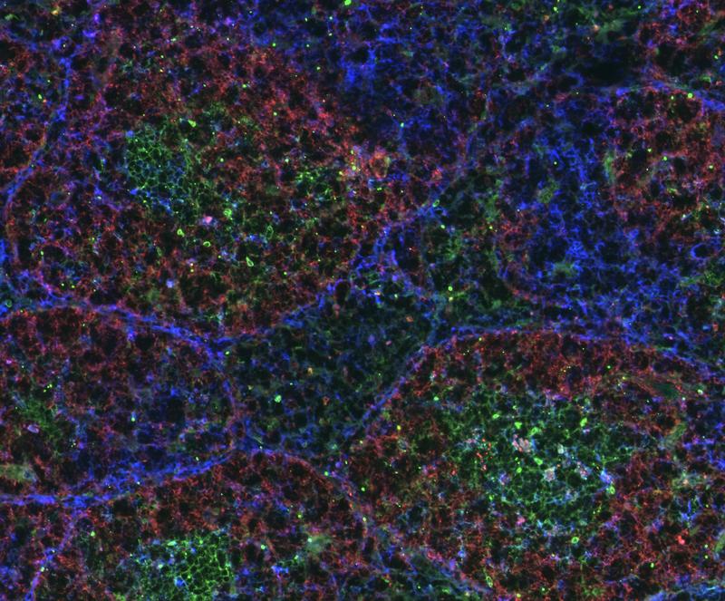Vergrößerte reaktive Zentren (Keimzentren) . Man erkennt, dass T-Zellen (blau) und B-Zellen (rot) interagieren und ein reaktives Keimzentrum bilden, in dem aktivierte B-Zellen grün dargestellt sind.