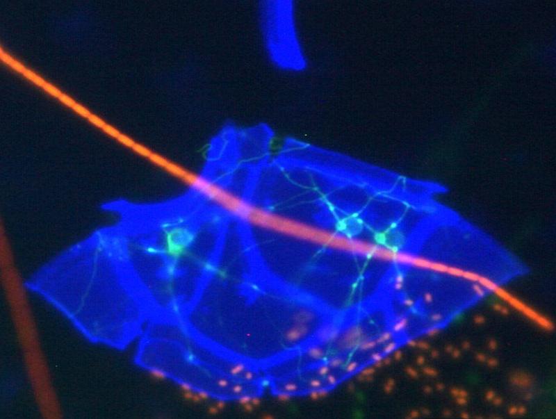 Aquatische Pilze (in Hellblau) siedeln auf einem Dinoflagellaten.