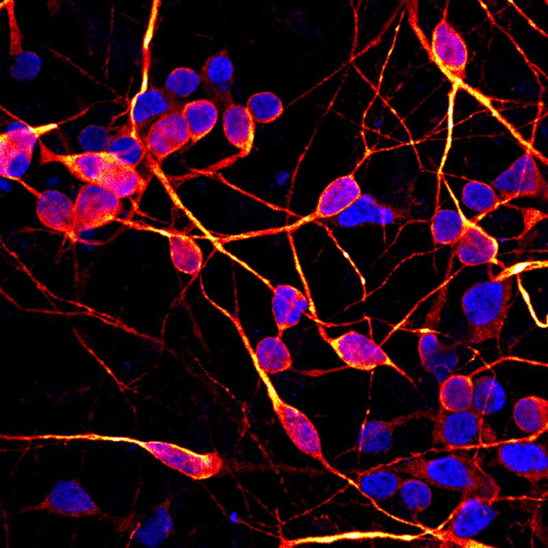 Zur Erforschung neurodegenerativer Erkrankungen wie ALS und Parkinson werden induzierte pluripotente Stammzellen (iPS-Zellen) genutzt.