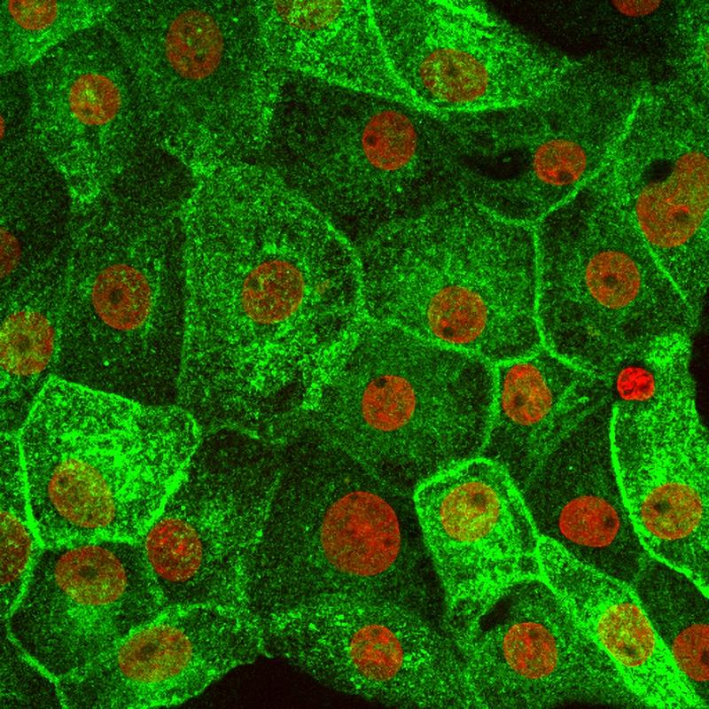 In den Nierenzellen der Ratte wandert das grün markierte Aquaporin AQP2 teilweise zur Zelloberfläche, sobald sie durch das Medikament Forskolin stimuliert wurden. Zellkerne erscheinen rot.
