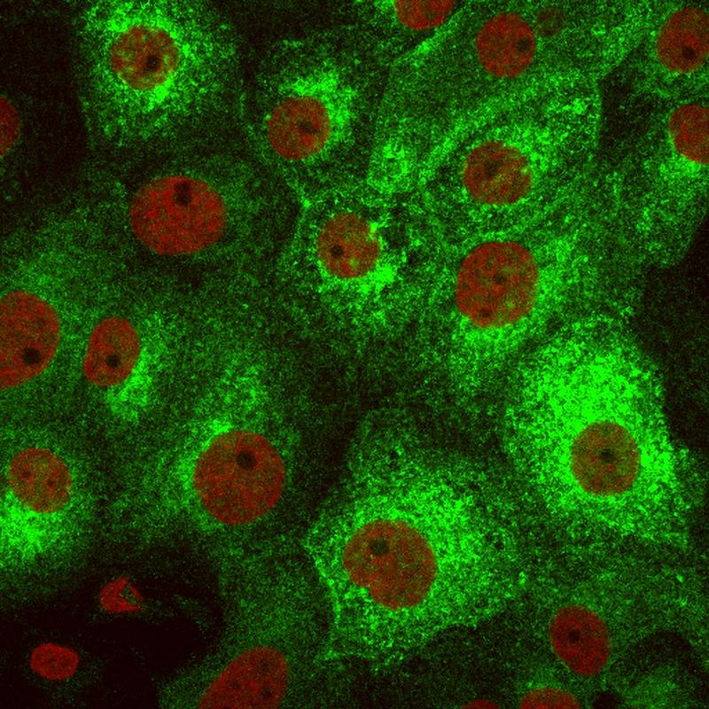 In den Nierenzellen der Ratte befindet sich das grün markierte Aquaporin AQP2 im Zellinneren, wenn sie weder durch das Hormon noch durch ein Medikament stimuliert wurden. Zellkerne erscheinen rot 