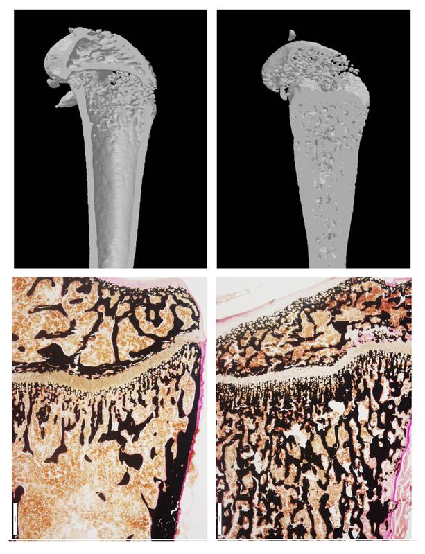 Oben: Oberschenkel-CT einer gesunden Maus und eines Osteopetrose-Mausmodells (rechts). Unten: Eingefärbte Oberschenkel-Schnitte einer gesunden Maus und eines Osteopetrose-Modells (rechts)