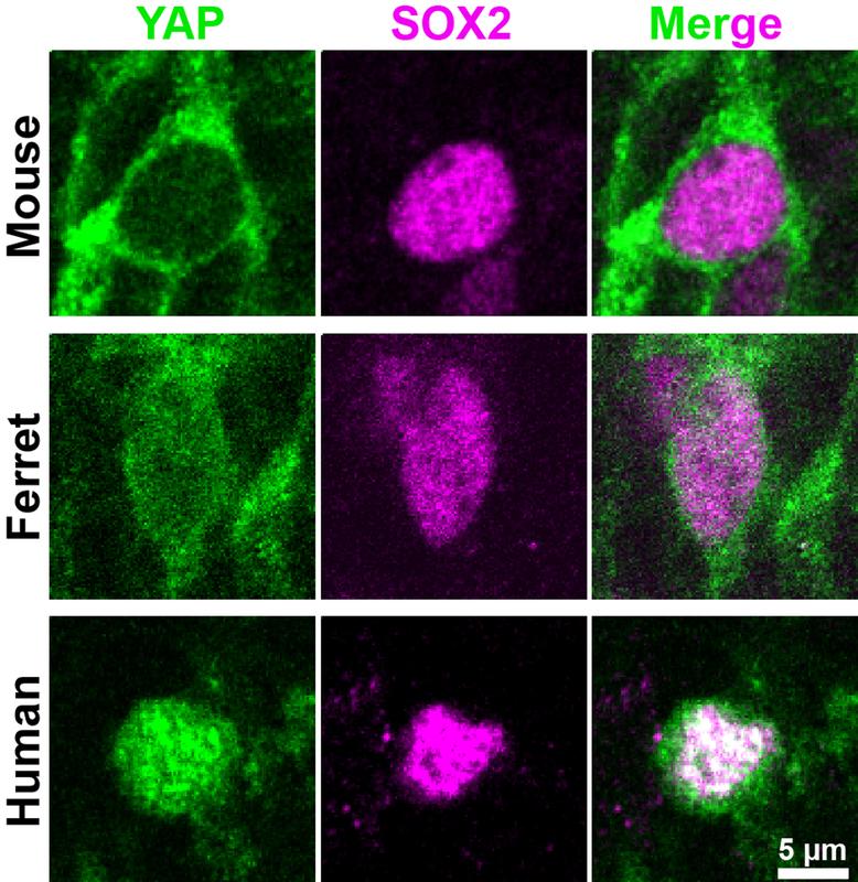 Embryonaler Neocortex von Maus, Frettchen, Mensch zeigt niedrige, mittlere bzw. hohe YAP-Werte (grün) in basalen Vorläufer-Zellkernen (magenta), wo YAP aktiv sein muss, um Zellvermehrung zu fördern.