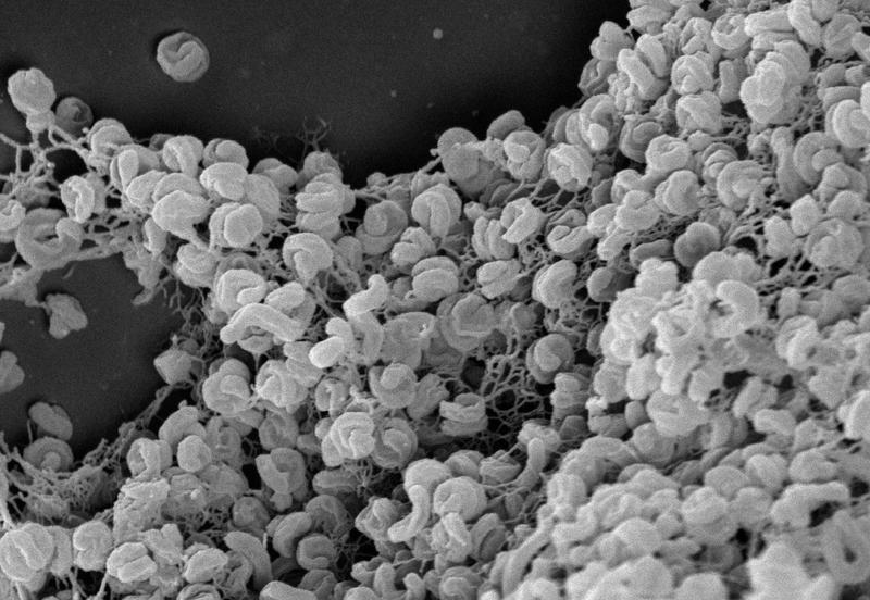 Elektronenmikroskopische Aufnahme eines Zell-Aggregats von Comammox-Bakterien der Art Nitrospira inopinata.