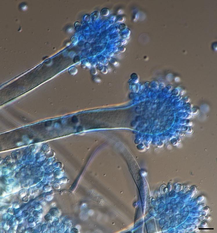 Mikroskopische Aufnahme eines typischen Schimmelpilzes in Orgeln: Aspergillus glaucus in 600-facher Vergrößerung. 