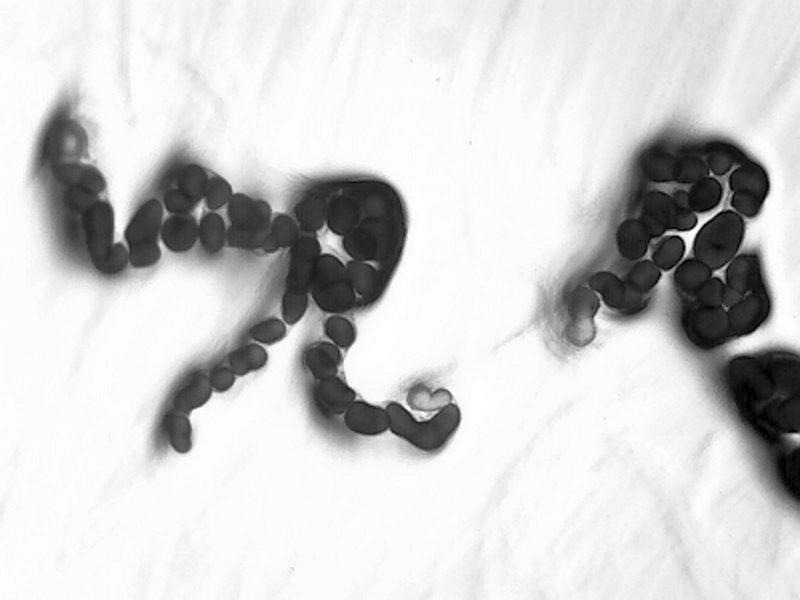 Microscopic image of the bacterium Cystobacter ferrugineus (DSM 14716)