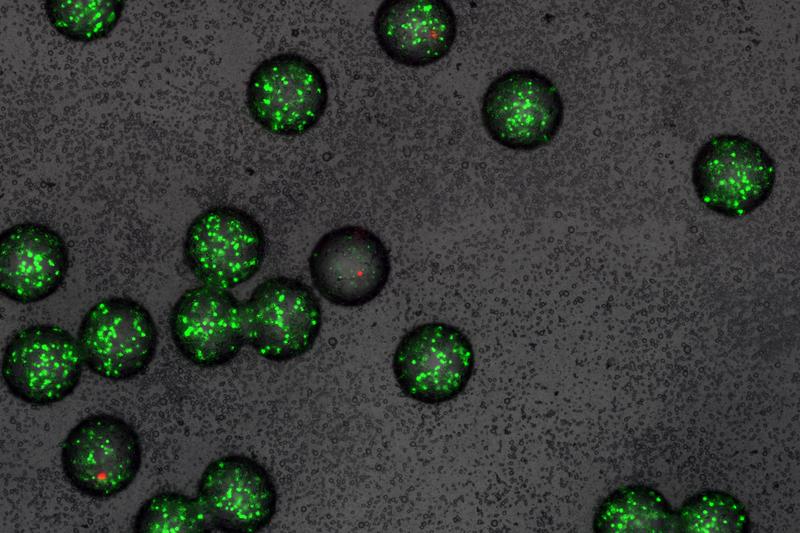 Mikro-Gel-Kügelchen mit grün fluoreszierenden Sensor-Bakterien. In einem der Kügelchen (Mitte) wurden die Sensor-Bakterien von einem Wirkstoff abgetötet (mikroskopische Aufnahme).