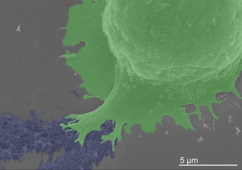 Rasterelektronmikroskop-Aufnahme eines Neurons (grün), welches Kontakt mit Nanofibrillen (blau) aufnimmt